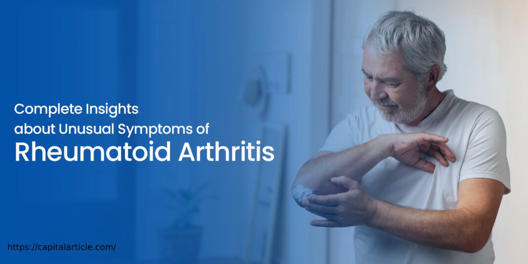 Anti-Rheumatic Drugs, Fatigue and Systemic Effects, Joint Pain and Stiffness, RA, Swelling and Joint Deformities